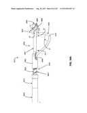 ARTICULATING TISSUE REMOVAL SYSTEMS AND METHODS diagram and image