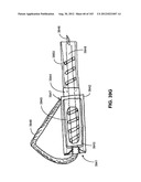 ARTICULATING TISSUE REMOVAL SYSTEMS AND METHODS diagram and image