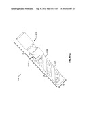 ARTICULATING TISSUE REMOVAL SYSTEMS AND METHODS diagram and image