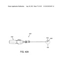 ARTICULATING TISSUE REMOVAL SYSTEMS AND METHODS diagram and image