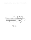 ARTICULATING TISSUE REMOVAL SYSTEMS AND METHODS diagram and image