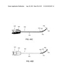 ARTICULATING TISSUE REMOVAL SYSTEMS AND METHODS diagram and image