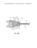 ARTICULATING TISSUE REMOVAL SYSTEMS AND METHODS diagram and image