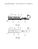 ARTICULATING TISSUE REMOVAL SYSTEMS AND METHODS diagram and image