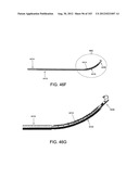 ARTICULATING TISSUE REMOVAL SYSTEMS AND METHODS diagram and image