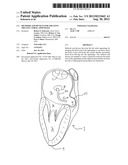 Methods And Devices For Treating The Left Atrial Appendage diagram and image