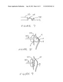 Methods And Devices For Treating The Left Atrial Appendage diagram and image