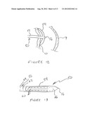 Methods And Devices For Treating The Left Atrial Appendage diagram and image