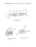 Methods And Devices For Treating The Left Atrial Appendage diagram and image