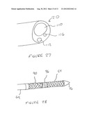 Methods And Devices For Treating The Left Atrial Appendage diagram and image