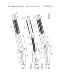 CATHETER GRIPPER diagram and image