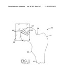 MODULAR ORTHOPAEDIC COMPONENT CASE diagram and image