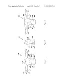 COMPRESSION GARMENTS AND METHOD OF MANUFACTURE diagram and image