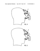 FOREHEAD SUPPORT FOR FACIAL MASK diagram and image