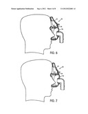 FOREHEAD SUPPORT FOR FACIAL MASK diagram and image