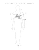 Surgical Drape With Selectively Detachable Barrier diagram and image