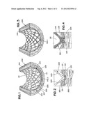 METHOD FOR MAKING GROOVES ON A LUMINAL SURFACE OF AN INTRAVASCULAR STENT diagram and image