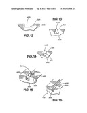 METHOD FOR MAKING GROOVES ON A LUMINAL SURFACE OF AN INTRAVASCULAR STENT diagram and image