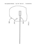 IMPLANTABLE OR INSERTABLE NUCLEAR MAGNETIC RESONANT IMAGING SYSTEM diagram and image