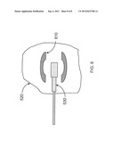 IMPLANTABLE OR INSERTABLE NUCLEAR MAGNETIC RESONANT IMAGING SYSTEM diagram and image