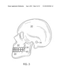 SYSTEM AND METHOD FOR DETECTING DEVIATIONS DURING THE COURSE OF AN     ORTHODONTIC TREATMENT TO GRADUALLY REPOSITION TEETH diagram and image