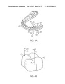 SYSTEM AND METHOD FOR DETECTING DEVIATIONS DURING THE COURSE OF AN     ORTHODONTIC TREATMENT TO GRADUALLY REPOSITION TEETH diagram and image