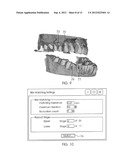 SYSTEM AND METHOD FOR DETECTING DEVIATIONS DURING THE COURSE OF AN     ORTHODONTIC TREATMENT TO GRADUALLY REPOSITION TEETH diagram and image