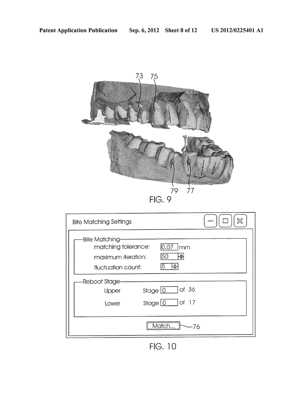 SYSTEM AND METHOD FOR DETECTING DEVIATIONS DURING THE COURSE OF AN     ORTHODONTIC TREATMENT TO GRADUALLY REPOSITION TEETH - diagram, schematic, and image 09
