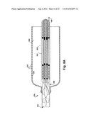 BLOOD PUMP diagram and image