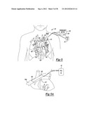 Multiple Sensor Input for Structure Identification diagram and image