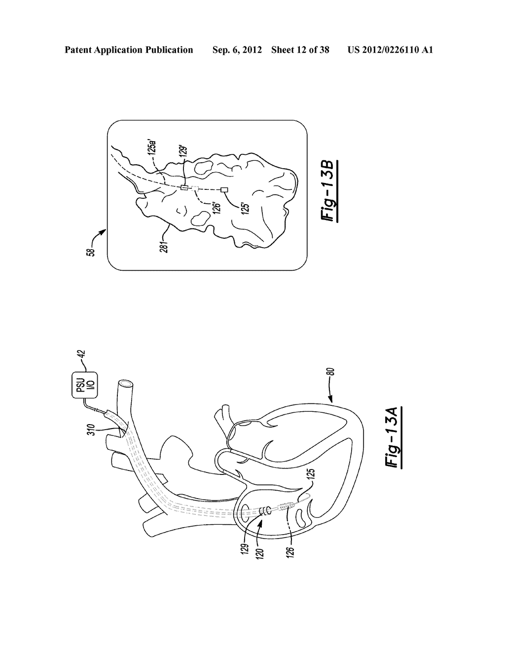 Multiple Sensor Input for Structure Identification - diagram, schematic, and image 13