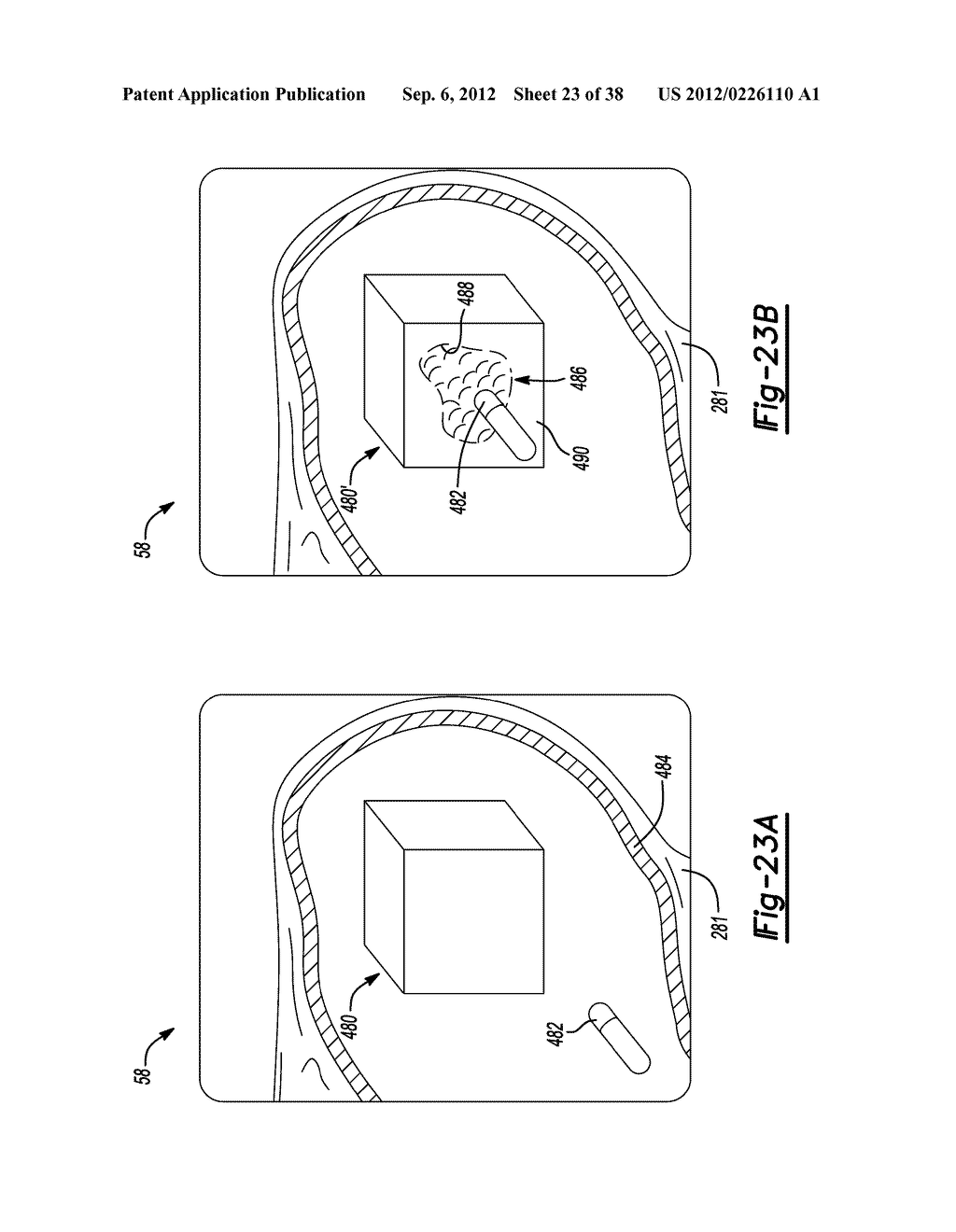 Multiple Sensor Input for Structure Identification - diagram, schematic, and image 24