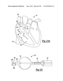 Multiple Sensor Input for Structure Identification diagram and image