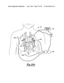 Multiple Sensor Input for Structure Identification diagram and image