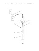 Method and Apparatus for Acquiring Data Relating to a Physiological     Condition of a Subject When Chest Wall Access is Limited diagram and image