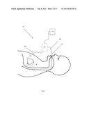 Method and Apparatus for Acquiring Data Relating to a Physiological     Condition of a Subject When Chest Wall Access is Limited diagram and image