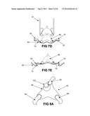 DEPLOYABLE MARKER AND METHOD FOR DEPLOYMENT diagram and image