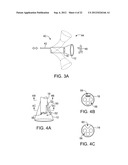 DELIVERY OF BIOLOGICAL COMPOUNDS TO ISCHEMIC AND/OR INFARCTED TISSUE diagram and image