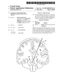 APPARATUS AND METHODS FOR BLOCKING NEEDLE AND CANNULA TRACTS diagram and image