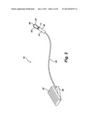 THERMALLY ADJUSTABLE SURGICAL TOOL, BALLOON CATHETERS AND SCULPTING OF     BIOLOGIC MATERIALS diagram and image