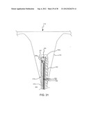 THERMALLY ADJUSTABLE SURGICAL TOOL, BALLOON CATHETERS AND SCULPTING OF     BIOLOGIC MATERIALS diagram and image