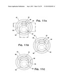 SYSTEM AND METHOD FOR MECHANICALLY POSITIONING INTRAVASCULAR IMPLANTS diagram and image