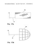 SYSTEM AND METHOD FOR MECHANICALLY POSITIONING INTRAVASCULAR IMPLANTS diagram and image