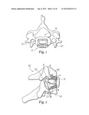 INTERBODY DEVICE AND PLATE FOR SPINAL STABILIZATION AND INSTRUMENTS FOR     POSITIONING SAME diagram and image