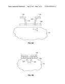 METHODS AND DEVICES FOR TREATING TISSUE diagram and image