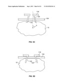 METHODS AND DEVICES FOR TREATING TISSUE diagram and image