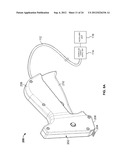 METHODS AND DEVICES FOR TREATING TISSUE diagram and image