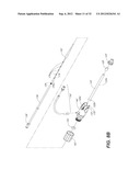 CATHETER SYSTEM AND METHODS OF USING SAME diagram and image