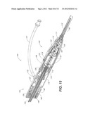 CATHETER SYSTEM AND METHODS OF USING SAME diagram and image