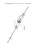 CATHETER SYSTEM AND METHODS OF USING SAME diagram and image